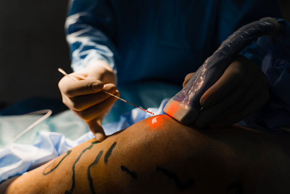 Chirurgie vasculaire